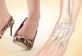 fractures-sprains-and-arthritis