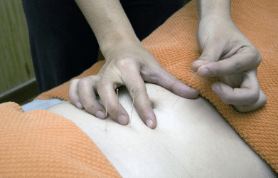 putting needles at the back of the body